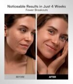 INIA Red Light Therapy Mask for Face – 4 Light Modes with 850nm NIR, Red & Blue LED Light Therapy, 2600mAh Rechargeable LED Face Mask for Radiant Glow at Home, Black - Image 2